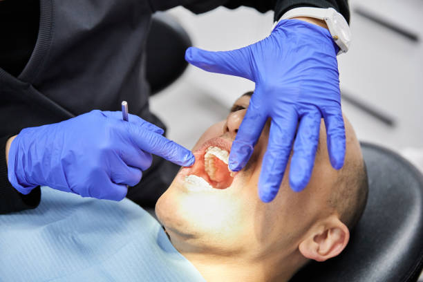 Best Emergency Dental Care for Sports Injuries in Dayton, MN